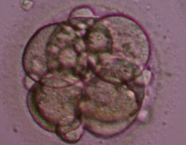 7-cell Grade II-III